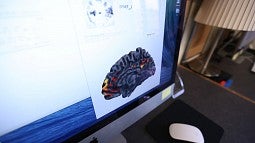 Model of brain displayed on computer screen