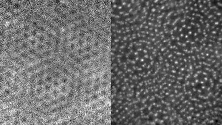 before and after images of microscopic technique